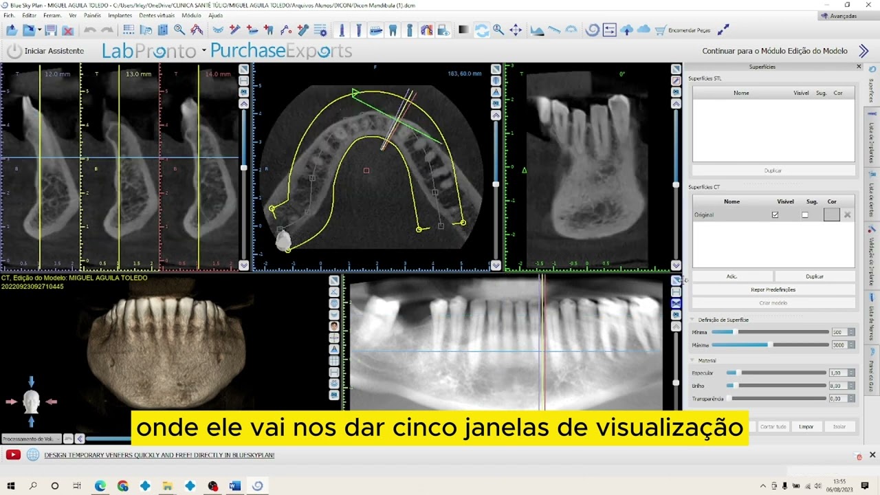 Vídeo Tutorial de Planejamento de Implante Dentário no Software Blue Sky Plan - INICIAL