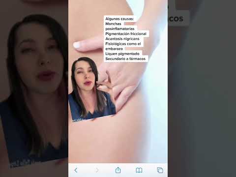 Dark Crotch? Tips from a Dermatologist 👩🏻‍⚕️