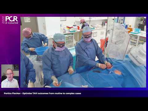 Portico FlexNav - Optimise TAVI outcomes from routine to complex cases - PCR e-Course 2020