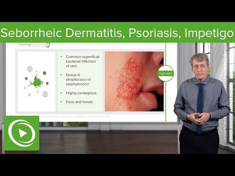 Psoriasis skin condition contagious