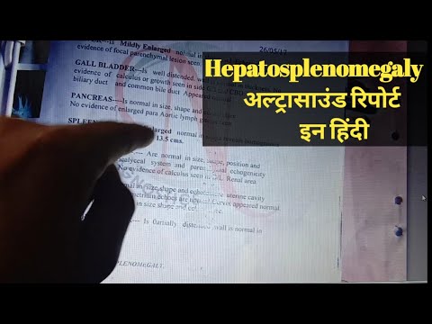 Hepatosplenomegaly क्या है, Liver Ultrasound report, लिवर अल्ट्रासाउंड, liver par sujan, USG