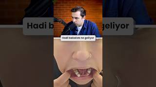 DİŞLERİ NE HALE GELMİŞ...