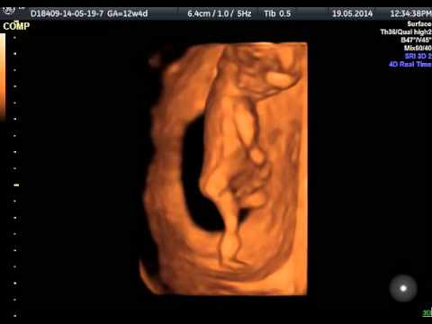 Feto 4D 12 settimane