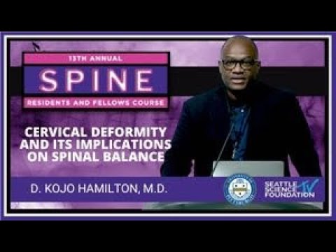 Cervical Deformity and Its Implications on Spinal Balance - D.  Kojo Hamilton, M.D.