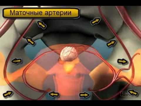 Размер миомы 12 недель в сантиметрах Размер миомы 12 недель в сантиметрах