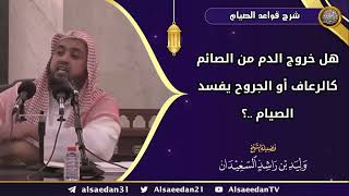 صورة هل خروج الدم من الصائم كالرعاف أو الجروح يفسد الصيام ..؟