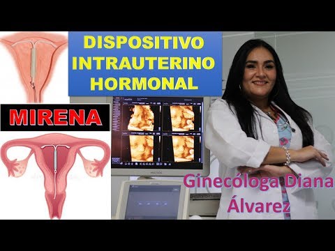 DISPOSITIVO INTRAUTERINO HORMONAL, por GINECOLOGA DIANA ALVAREZ