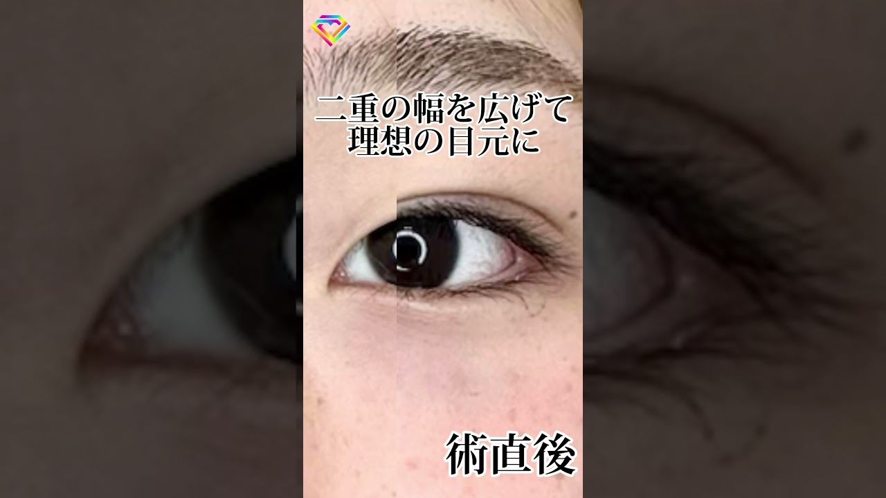 Youtubeのサムネイル