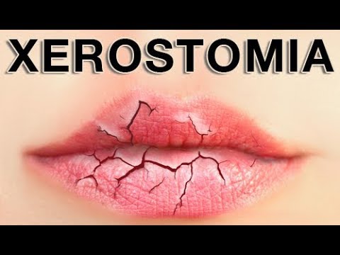 What Causes Dry Mouth? | Home Remedies (2019)