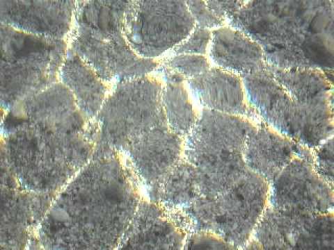Può osteocondrosi del dipartimento cervicale di una febbre Se sei caduto giù per le scale sul retro del dolore
