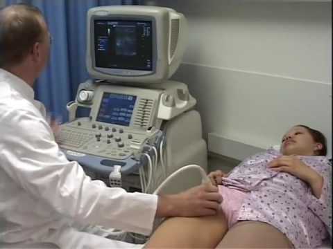 Radiojodtherapie von Prostata- Heilung Prostata Fibrose