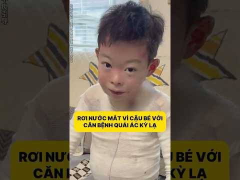 Rơi nước mắt vì cậu bé với căn bệnh quái ác kỳ lạ #comedyshorts