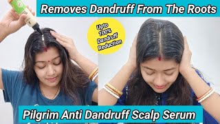 New Pilgrim Anti Dandruff Scalp Serum| 100% Dandruff Reduction | Honest Review & Demo|Krrish Sarkar