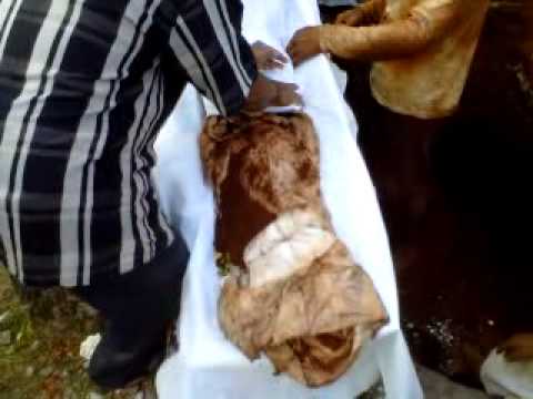 Metode kuno impotensi Fisioterapi untuk potensi