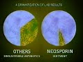 Neosporin Commercial From 1997