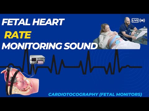 baby incubator incubator machine baby incubator working principle baby incubator uses