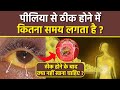 Piliya Thik Hone Me Kitna Samay Lagta Hai Piliya Thik Hone Ke Baad Kya Nahi Khaye Boldsky