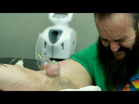 Braun Strowman’s Elbow Surgery And Harrowing Rehab: Remaking The Monster – Episode 1