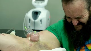 Braun Strowman&#39;s elbow surgery and harrowing rehab: Remaking The Monster - Episode 1