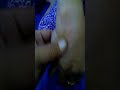 Refleksi Tapak Tembus Penyembuhan Azam Urat Kolesterol Tinggi