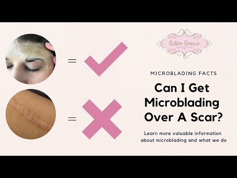 Can I Get Microblading Over A Scar?