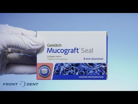 Hogyan használd a Mucograft Seal-t