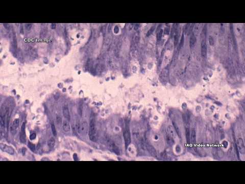 Paraziták a nyálkahártya bőrén
