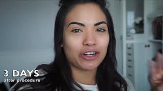 WHAT I WISH I WOULD HAVE KNOWN BEFORE GETTING MICROBLADING EYEBROWS