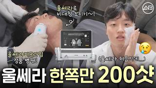 의사가 직접 받은 한쪽만 울쎄라 200샷