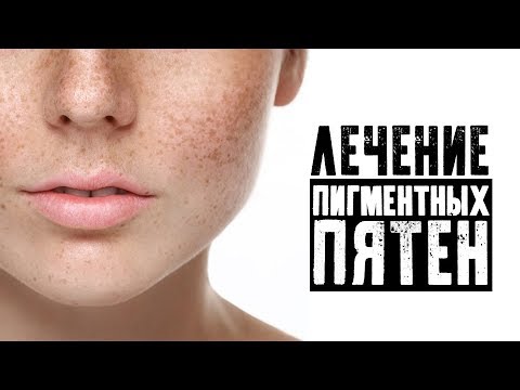 Все об отбеливании кожи от загара Интернет магазин веснушка харьков
