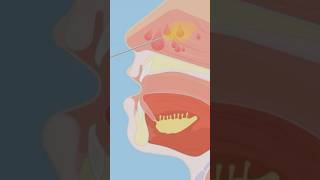 Functional Endoscopic Sinus Surgery (FESS) – What to Expect & Recovery Tips