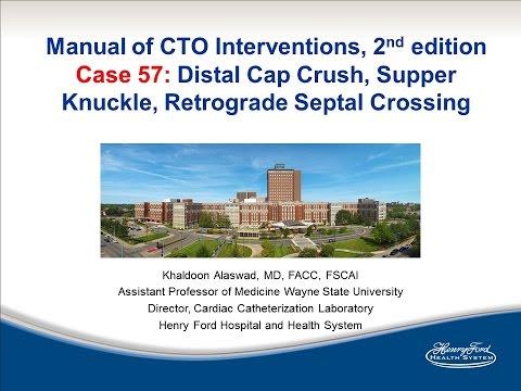 Case 57: Manual of CTO Interventions - Retrograde via LIMA and "tip in"