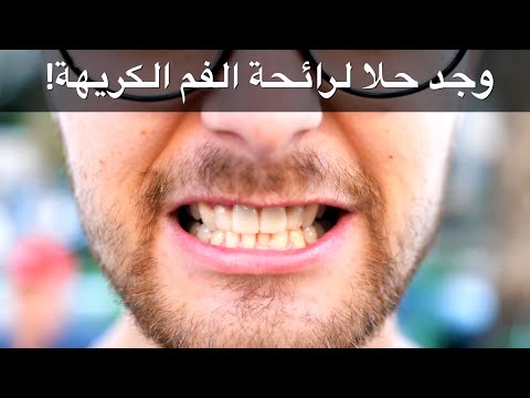 وجد حلا لرائحة الفم الكريهة ؟