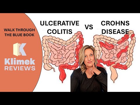 CROHNS VS ULCERATIVE COLITIS
