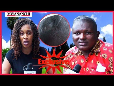 Aishi miaka 8 ubongo wazi, aomba matibabu
