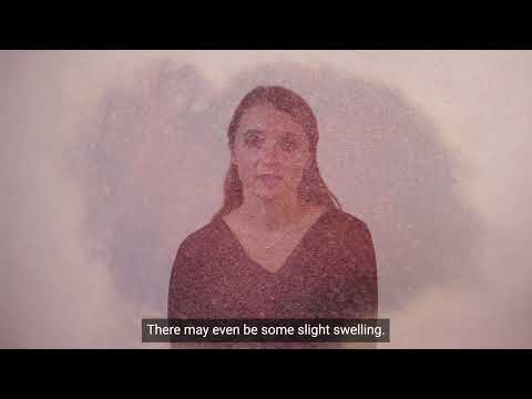 Cardiac Ablations for Abnormal Heart Rhythms: What to Expect After Your Procedure