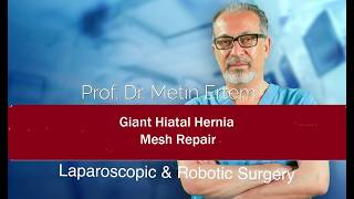 Miniaturka - Giant Hiatal Hernia, Laparoscopic repair with mesh. MD FACS Metin Ertem