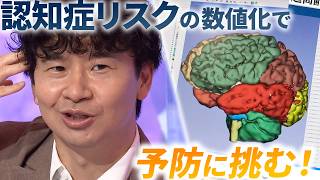 脳のMRI画像をデータ化 認知症予防に挑む！【アンパラレルド】