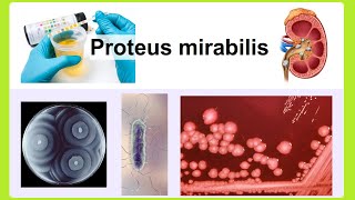 Proteus mirabilis