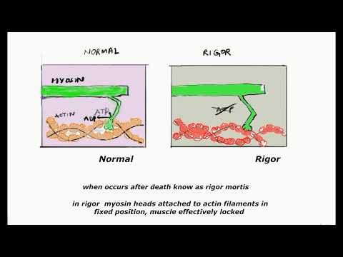 Rigor type of muscle contraction/ rigor mortis