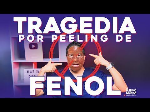TRAGEDIA POR PEELING DE FENOL