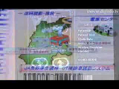 Paxis Pro server : DigInfo