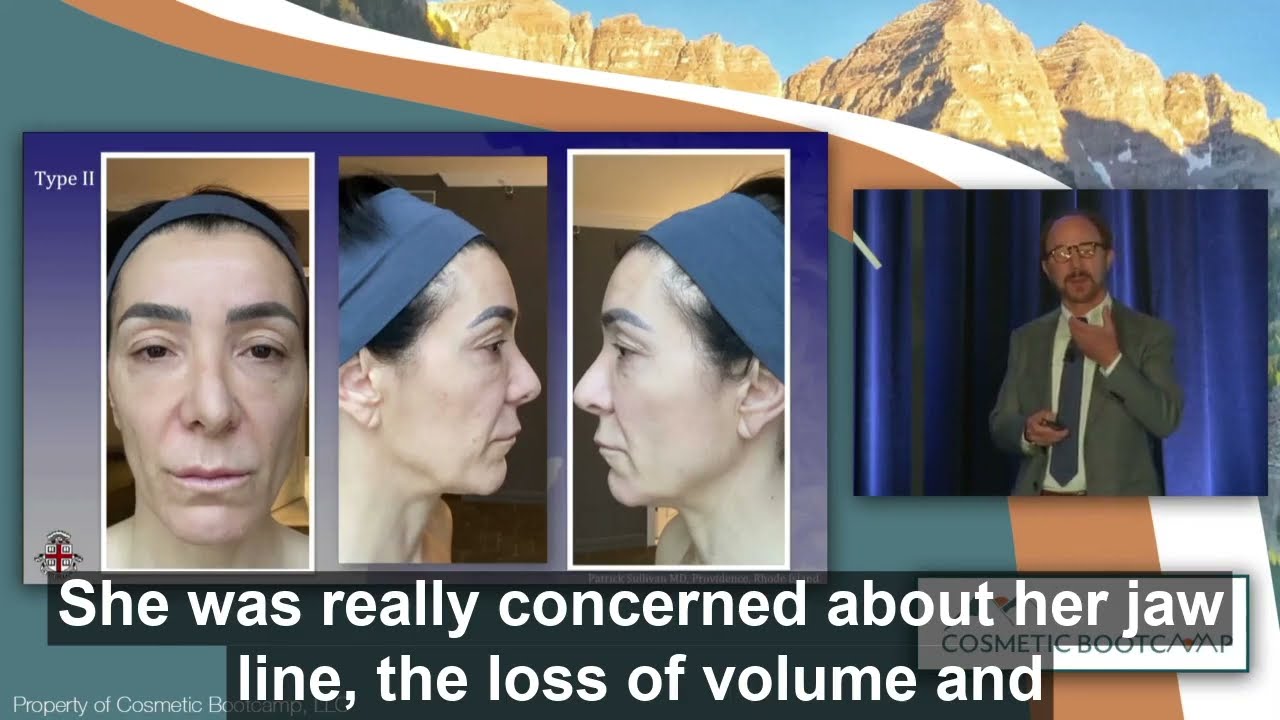 Dr. Sullivan Talks About Jawline Shaping