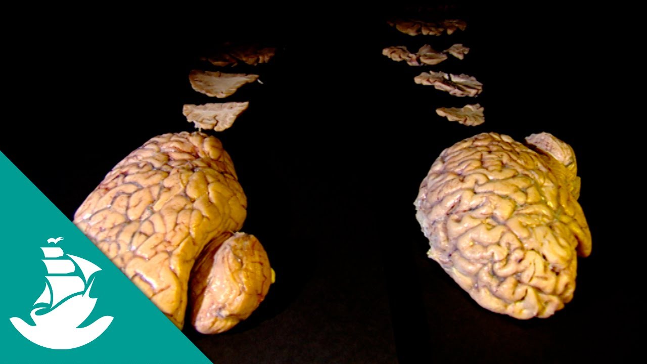 The Brain, the Last Enigma