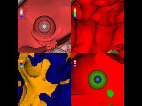 Supernova explosion  -  zoom50 - M187A model