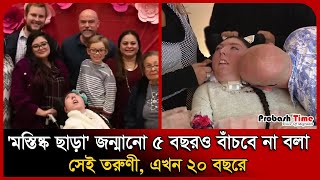 Download lagu 'মস্তিষ্ক ছাড়া' জন্মানো ৫ বছরও বাঁচবে না বলা সেই তরুণী , এখন ২০ বছরে । Miracle । Probash Time mp3 Download lagu 'মস্তিষ্ক ছাড়া' জন্মানো ৫ বছরও বাঁচবে না বলা সেই তরুণী , এখন ২০ বছরে । Miracle । Probash Time mp3