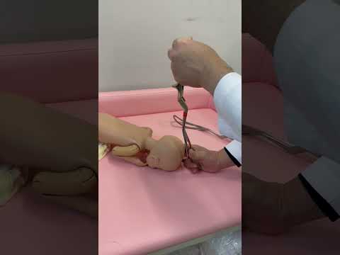 1813年にモールデンで発見されたチェンバレン鉗子とレバー