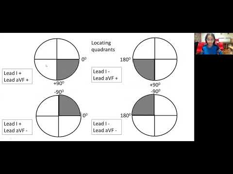 Pedicardio classes on ECG axis determination by Dr Sejal Shah