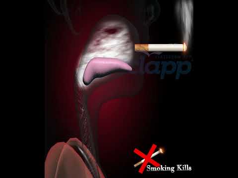 Smoking kills (3D animation)