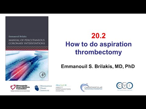 20.2 Aspiration thrombectomy step-by-step: Manual of PCI